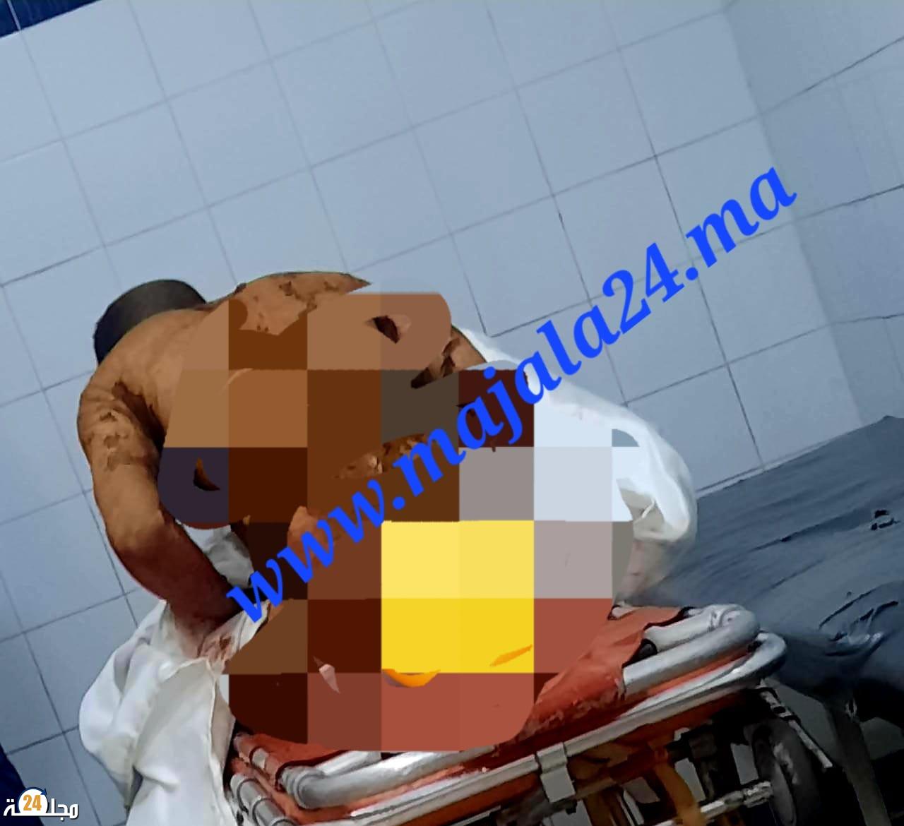 صادم… شخص يضرم النار في جسده بالقرب جامعة الحسن الاول بسطات