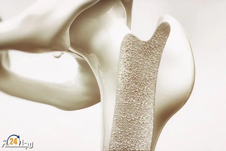 أسباب وعلاج التهاب العظام والنخاع