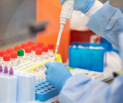 إطلاق شبكة عالمية جديدة للكشف عن الأمراض المعدية