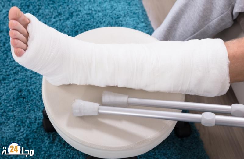 تبريد أنسجة العظام يسرع الشفاء من الكسور!