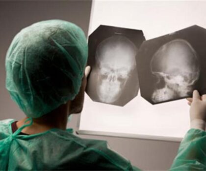 طبيبة أعصاب توضح  كيفية تجنب الوقوع في الخرف