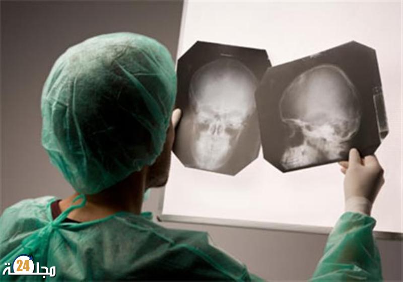 طبيبة أعصاب توضح  كيفية تجنب الوقوع في الخرف