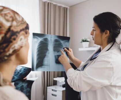 بارقة أمل.. علاج يخفض معدل وفيات سرطان الرئة إلى النصف