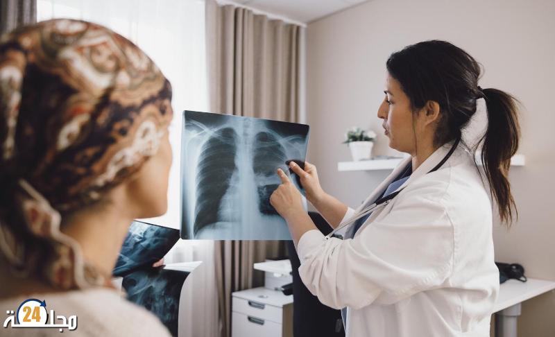 بارقة أمل.. علاج يخفض معدل وفيات سرطان الرئة إلى النصف