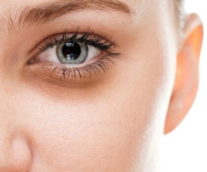 تحذير.. “الهالات السوداء” لها دلالات خطيرة