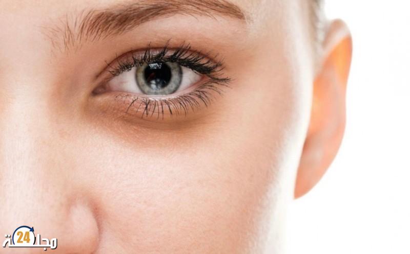 تحذير.. “الهالات السوداء” لها دلالات خطيرة