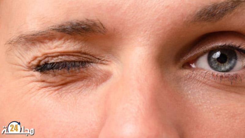 ما هي أسباب ارتعاش العينين ؟