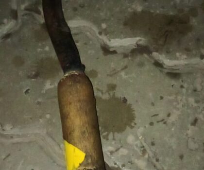 اعتداء شنيع بواسطة منجل على قاصر من طرف عائلة معادية له بسيدي يوسف بن علي بمراكش