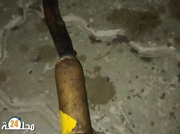 اعتداء شنيع بواسطة منجل على قاصر من طرف عائلة معادية له بسيدي يوسف بن علي بمراكش