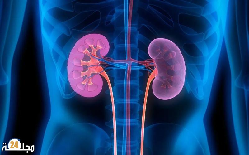 قلة السوائل ترفع خطر الإصابة بحصوات الكلى