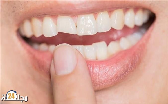 ثورة طبية.. دواء يعيد نمو الأسنان التالفة من جديد