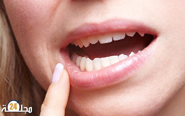 جفاف الفم.. علامة “حمراء” على 5 أمراض خطيرة