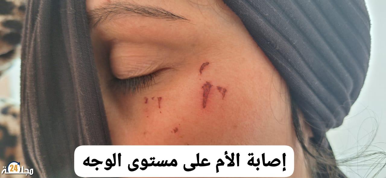 شخص يتسبب في نزيف داخلي لسيدة و يرسلها المستشفى ويعتدون على ابنها وأمها بأحد ولاد فرج