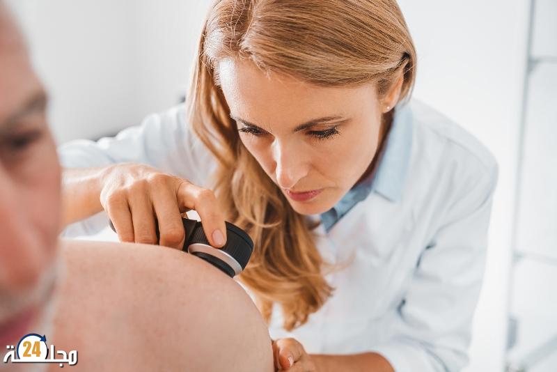 علاج جديد لأخطر أشكال سرطان الجلد يقلل من خطر عودة المرض والوفاة