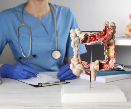 نصيحتين لتقليل خطر سرطان الأمعاء