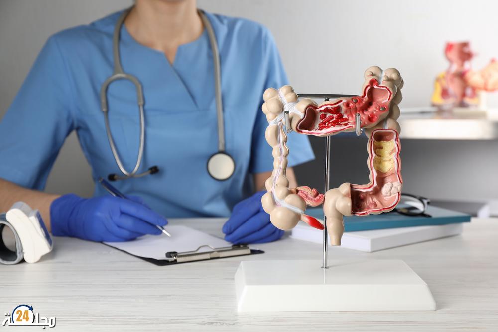 نصيحتين لتقليل خطر سرطان الأمعاء
