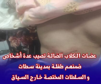 عضات الكلاب الضالة تصيب عدة أشخاص ضمنهم طفلة بمدينة سطات و السلطات المختصة خارج السياق