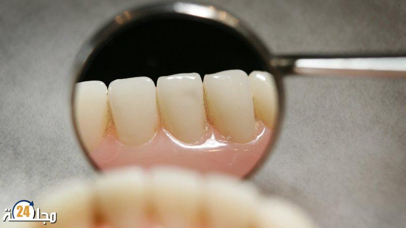 خطأ شائع يؤدي إلى اصفرار الأسنان