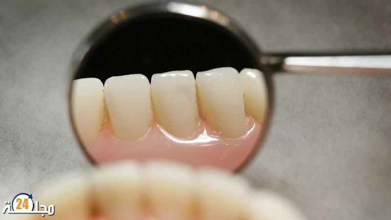 خطأ شائع يؤدي إلى اصفرار الأسنان