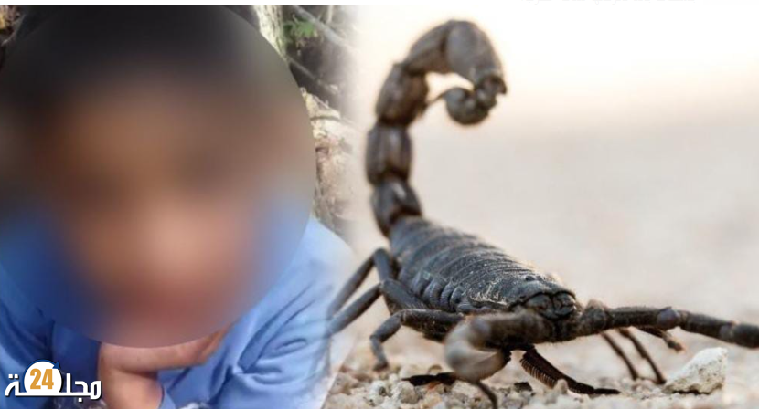 لسعة عقرب تنهي حياة طفلة بضواحي البروج