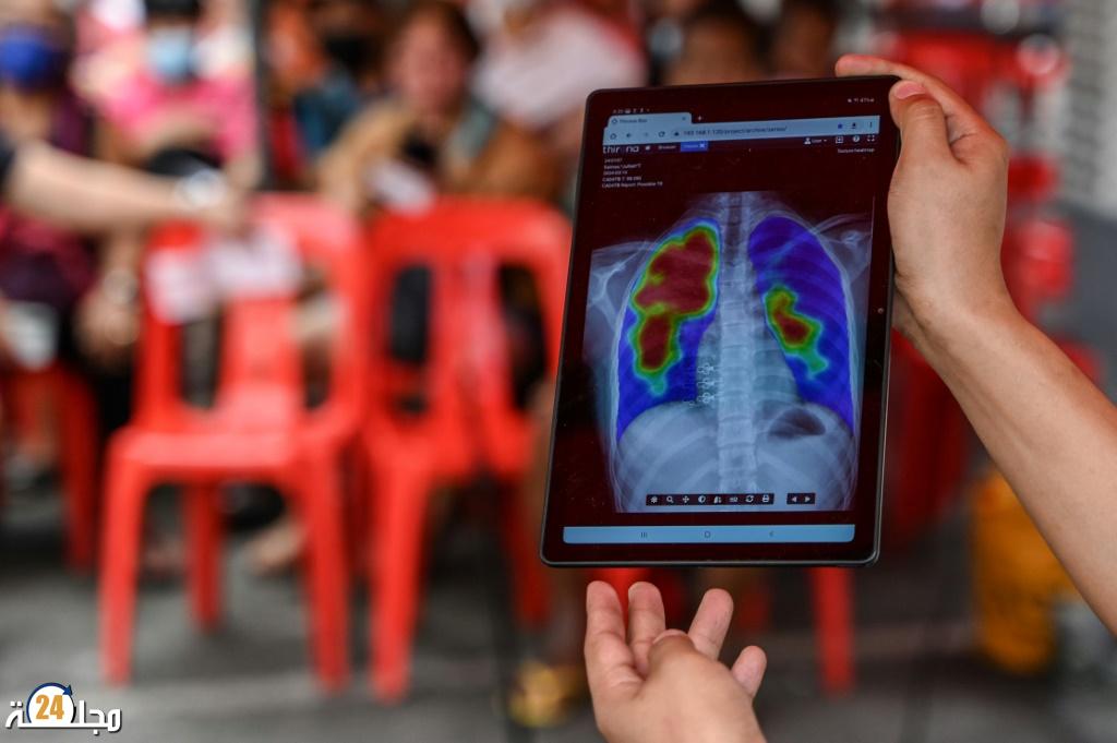 رخيص الثمن.. جهاز خارق يشخص السرطان في ساعة