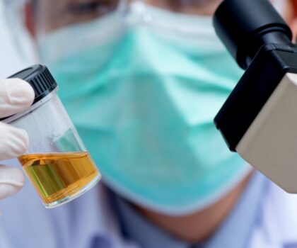 “خلايا الزومبي”.. اختبار للبول يكشف عن مرض خطير