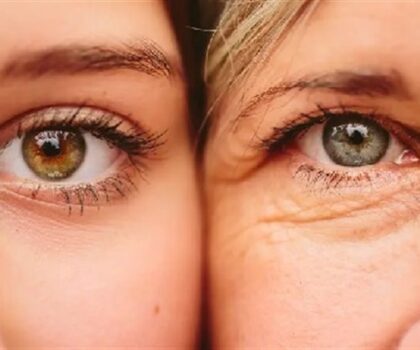 تجاعيد الوجه قد تكون أكثر من مجرد علامة على الشيخوخة!