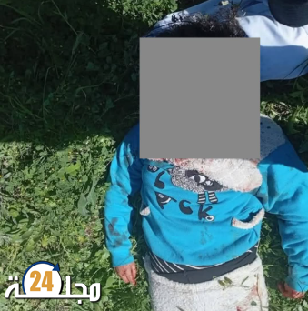 خنيفرة ….الاعتداء على زوجين في تبركانين نزاع عنيف ينتهي بالقبض على الجاني