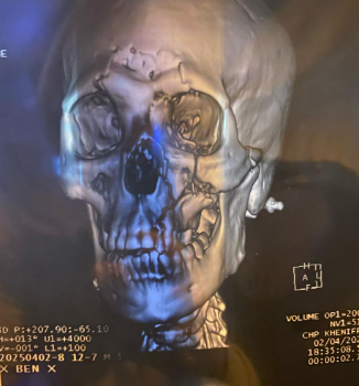 معاناة مريض من خنيفرة بين الإهمال ورفض المستشفيات لاستقباله