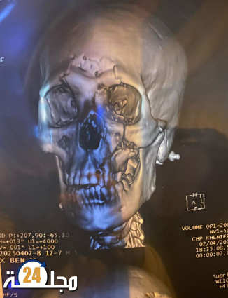 معاناة مريض من خنيفرة بين الإهمال ورفض المستشفيات لاستقباله