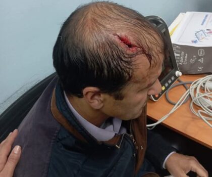 خنيفرة ….الاعتداء على زوجين في تبركانين نزاع عنيف ينتهي بالقبض على الجاني