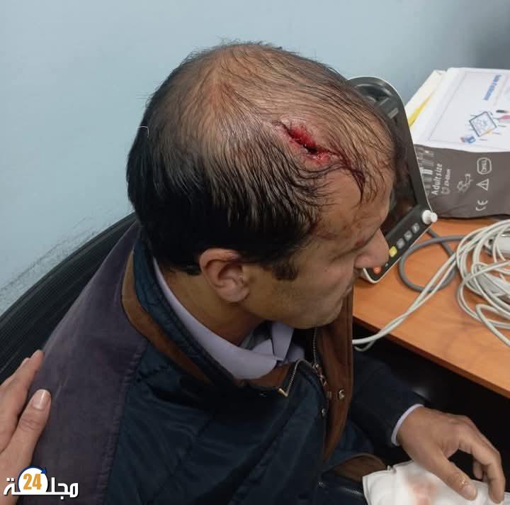 خنيفرة ….الاعتداء على زوجين في تبركانين نزاع عنيف ينتهي بالقبض على الجاني