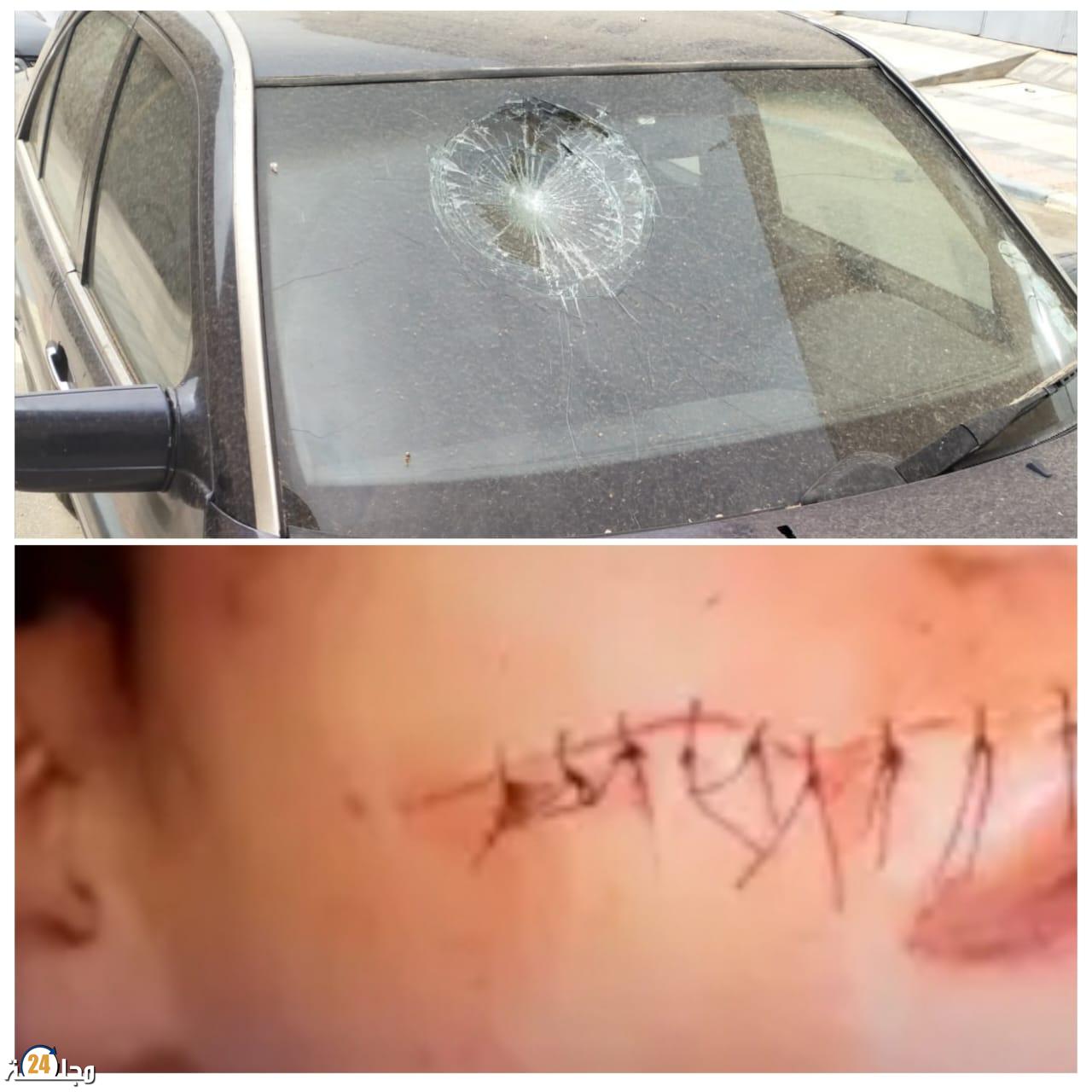 البروج : توقيف شخص متورط في قضية عنف باستعمال السلاح الأبيض