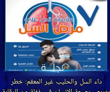 أزلو محمد يكتب: داء السل والحليب غير المعقم