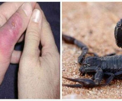 حين يلدغ الصمت: مأساة رضيع ورزازات تكشف جراح الصحة في المغرب