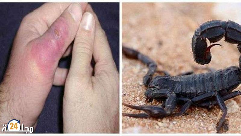 حين يلدغ الصمت: مأساة رضيع ورزازات تكشف جراح الصحة في المغرب