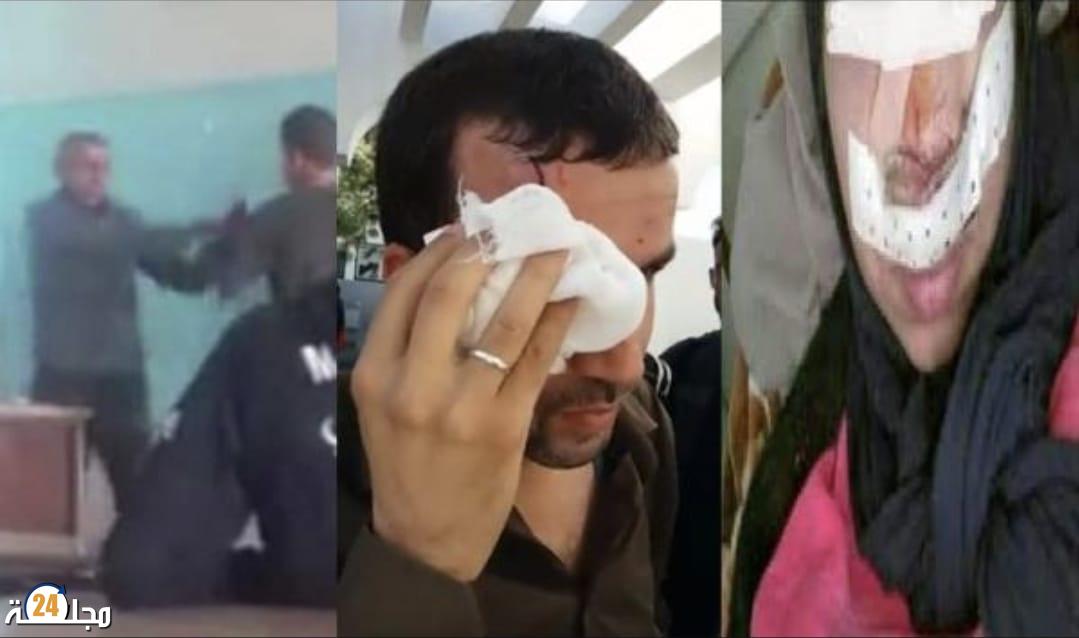 اعتداءات متتالية تهز قطاع التعليم بالجديدة وسط غياب الحماية داخل المؤسسات