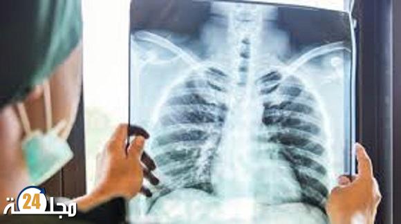 الشبكة المغربية للدفاع عن الحق في الصحة تحذر من تدهور وبائي خطير لداء السل بالمغرب