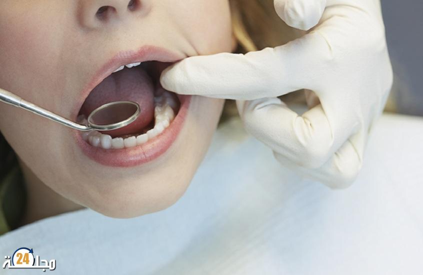 دراسة طبية تؤكد أهمية العناية بالأسنان في الحد من مضاعفات مرض تليف الكبد