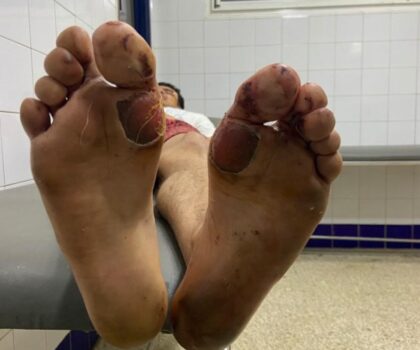 سطات..عصابة إجرامية تعتدي على مواطن بحي السلام و تخلق الرعب في صفوف ساكنته