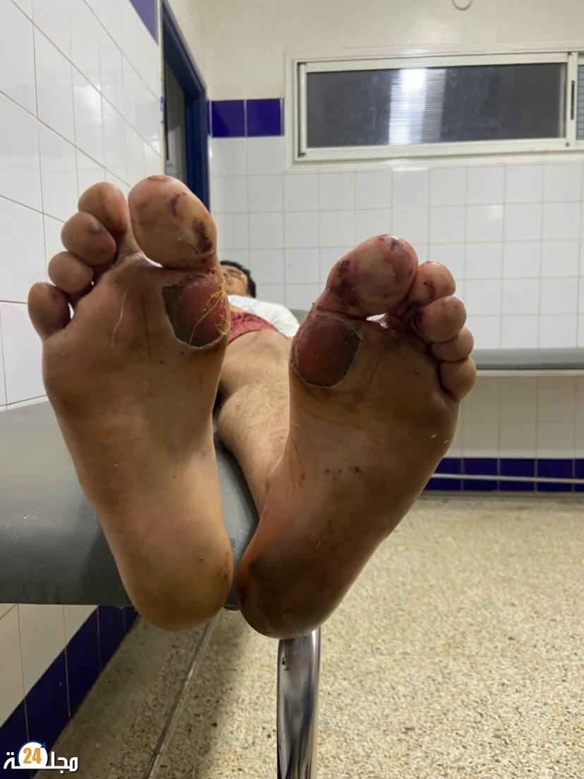 سطات..عصابة إجرامية تعتدي على مواطن بحي السلام و تخلق الرعب في صفوف ساكنته
