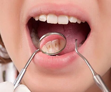علامات خفية في فمك تنذر بأمراض خطيرة.. طبيبة تحذر من تجاهلها