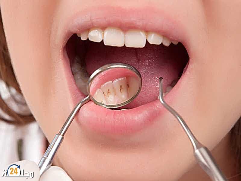 علامات خفية في فمك تنذر بأمراض خطيرة.. طبيبة تحذر من تجاهلها