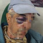 اعتداء على مسن بتارودانت.. إصابات بليغة ومطالب بفتح تحقيق في ظروف وملابسات القضية